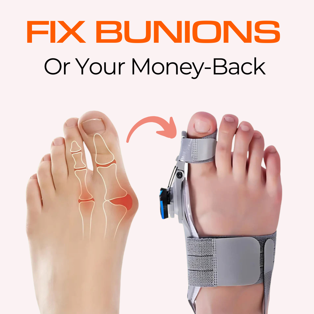 Bunion Corrector
